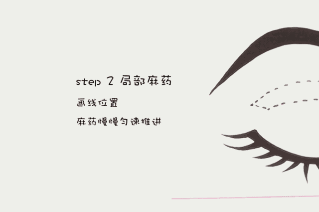双眼皮7.gif