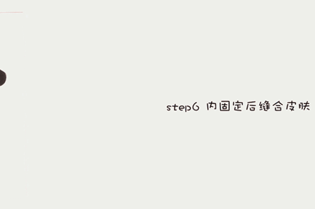 双眼皮11.gif