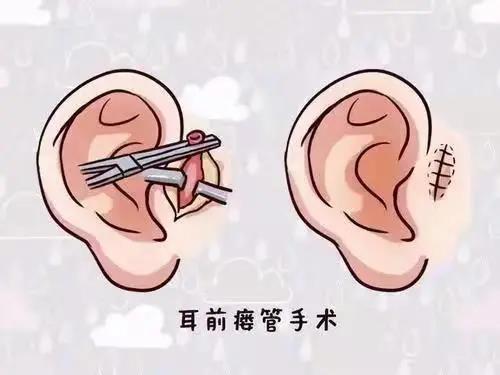小洞10.jpg