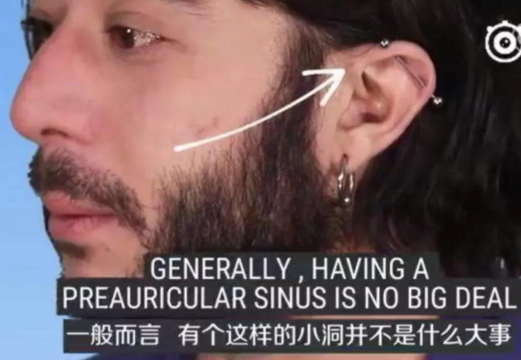 小洞8.jpg