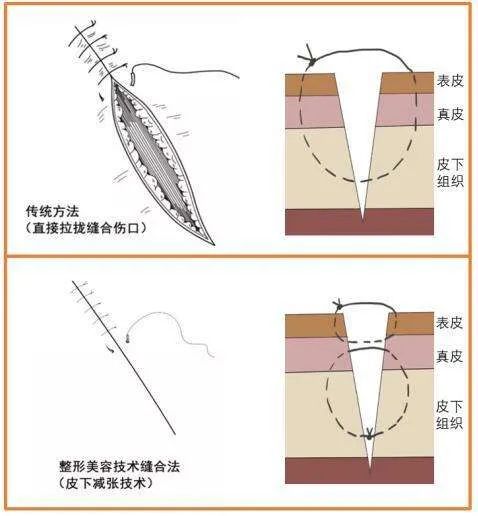 乳腺手术4.jpg